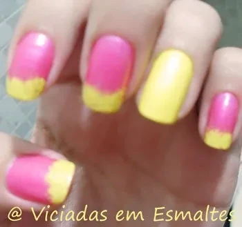 unhas