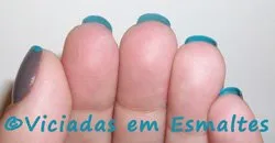 unhas
